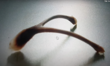 furcula