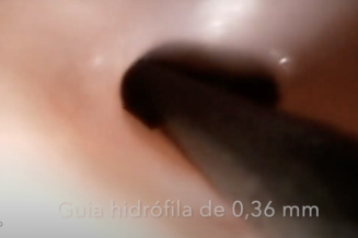 gata